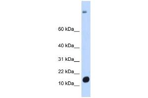 C6ORF201 antibody used at 1 ug/ml to detect target protein. (C6orf201 antibody  (N-Term))