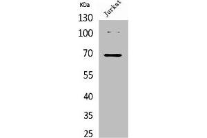 Western Blot analysis of Jurkat cells using Acetyl-Ku-70 (K542) Polyclonal Antibody. (XRCC6 antibody  (acLys542))