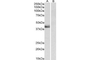 ABIN4902761 (0. (SERPINB1 antibody)