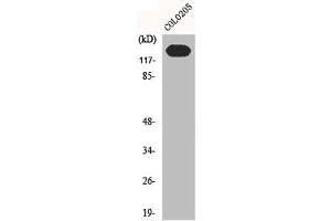 Western Blot analysis of C0L0205 cells using N-cadherin Polyclonal Antibody (N-Cadherin antibody  (C-Term))