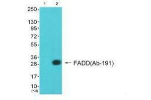 Western blot analysis of extracts from A549 cells (Lane 2), using FADD (Ab-191) antiobdy. (FADD antibody  (C-Term))