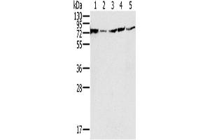 Western Blotting (WB) image for anti-NADH Dehydrogenase (Ubiquinone) Fe-S Protein 1, 75kDa (NADH-Coenzyme Q Reductase) (NDUFS1) antibody (ABIN2430527) (NDUFS1 antibody)