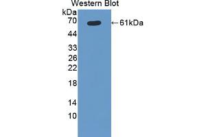 Western blot analysis of the recombinant protein. (CYP11B1 antibody  (AA 1-498))