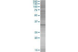 NKX2-8 transfected lysate. (NKX2-8 293T Cell Transient Overexpression Lysate(Denatured))