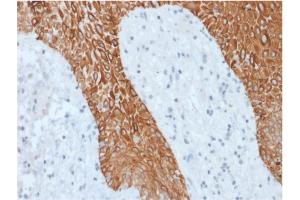 Formalin-fixed, paraffin-embedded human Skin stained with Multi-Cytokeratin Recombinant Rabbit Monoclonal Antibody (KRT/1877R). (Recombinant Cytokeratin, Multi (Epithelial Marker) antibody)
