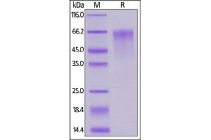 Mouse FGF R4, His Tag on  under reducing (R) condition. (FGFR4 Protein (AA 17-366) (His tag))