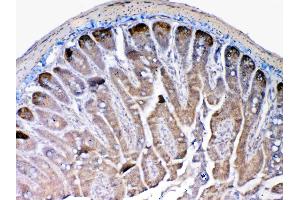 IHC analysis of MMP13 using anti-MMP13 antibody . (MMP13 antibody  (AA 99-335))