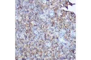 Immunohistochemistry of paraffin-embedded human tonsil using CD20 Rabbit pAb (ABIN7268473) at dilution of 1:150 (40x lens). (CD20 antibody  (AA 208-297))