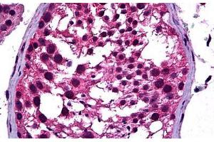 Human Testis: Formalin-Fixed, Paraffin-Embedded (FFPE) (NEUROD1 antibody  (AA 201-300))