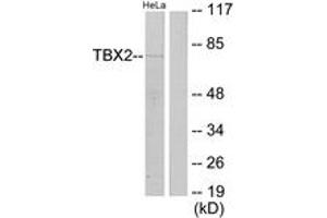 Western Blotting (WB) image for anti-T-Box 2 (TBX2) (AA 251-300) antibody (ABIN2889569) (TBX2 antibody  (AA 251-300))
