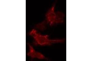 ABIN6275607 staining  HeLa cells by IF/ICC. (SFRS2B antibody  (Internal Region))