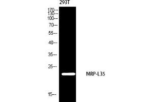 Western blot analysis of 293 using MRP-L35 antibody. (MRPL35 antibody  (AA 80-160))