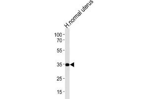 Western Blotting (WB) image for anti-CUB and Zona Pellucida-Like Domains 1 (CUZD1) antibody (ABIN2996044) (CUZD1 antibody)