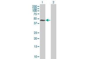 Western Blotting (WB) image for TSG101 293T Cell Transient Overexpression Lysate(Denatured) (ABIN1333798)