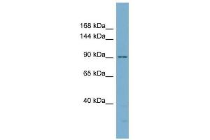 Catenin antibody used at 1 ug/ml to detect target protein. (Catenin antibody)