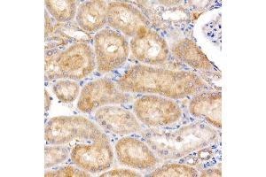 Immunohistochemistry of paraffin-embedded rat kidney using MT-ND4 Rabbit pAb (ABIN7268602) at dilution of 1:250 (40x lens). (Mitochondrially Encoded NADH Dehydrogenase 4 (MT-ND4) antibody)