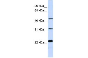 WB Suggested Anti-FAM153B Antibody Titration: 0. (FAM153B antibody  (Middle Region))