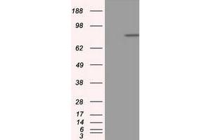 Western Blotting (WB) image for anti-Amyloid beta (A4) Precursor Protein (APP) antibody (ABIN1496881) (APP antibody)