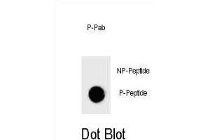 Dot blot analysis of Phospho-BAD- Antibody Phospho-specific Pab h on nitrocellulose membrane. (BAD antibody  (pThr137))