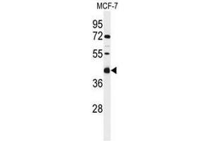Western blot analysis of CI091 Antibody (C-term) in MCF-7 cell line lysates (35µg/lane). (C9ORF91 antibody  (C-Term))