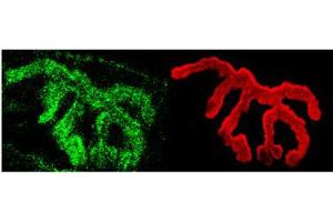 Piccolo Immunofluorescence. (PCLO antibody)