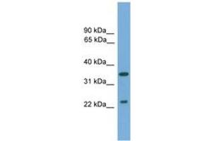 Image no. 1 for anti-WNT Inhibitory Factor 1 (WIF1) (AA 71-120) antibody (ABIN6744960) (WIF1 antibody  (AA 71-120))