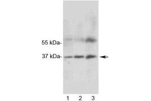 Western blot testing of 1) rat heart, 2) rat skeletal muscle and 3) human MCF7 lysate with MRGX1 antibody. (MRGPRX1 antibody)