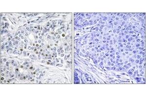 Immunohistochemistry (IHC) image for anti-Retinoblastoma Protein (Rb Protein) (AA 791-840) antibody (ABIN2888774) (Retinoblastoma Protein (Rb) antibody  (AA 791-840))