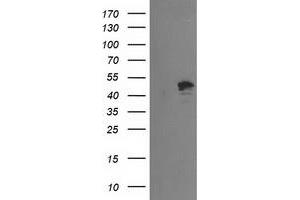 HEK293T cells were transfected with the pCMV6-ENTRY control (Left lane) or pCMV6-ENTRY PTPN7 (Right lane) cDNA for 48 hrs and lysed. (PTPN7 antibody)