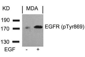 Western blot analysis of extracts from MDA cells untreated or treated with EGF using EGFR(Phospho-Tyr869) Antibody. (EGFR antibody  (pTyr869))