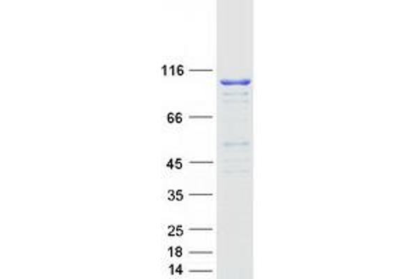 Mars (MARS) protein (Myc-DYKDDDDK Tag)