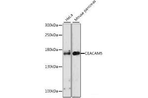 Western blot analysis of extracts of various cell lines using CEACAM5 Polyclonal Antibody at dilution of 1:1000. (CEACAM5 antibody)