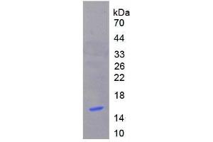 SDS-PAGE analysis of Human Metallothionein 1 Protein. (MT1 Protein)