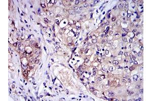 Immunohistochemistry (IHC) image for anti-Interleukin-1 Receptor-Associated Kinase 4 (IRAK4) antibody (ABIN969218)