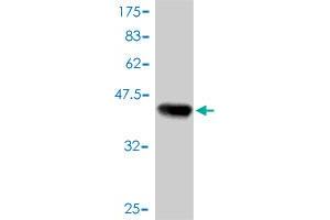 Western Blot detection against Immunogen (38. (Retinoic Acid Receptor alpha antibody  (AA 315-424))