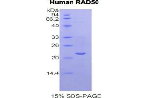 SDS-PAGE analysis of Human RAD50 Protein. (RAD50 Protein)