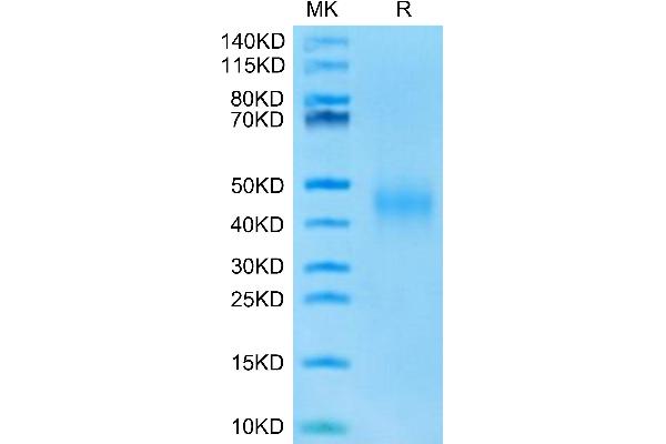IL-9 Protein (AA 19-144) (His tag)