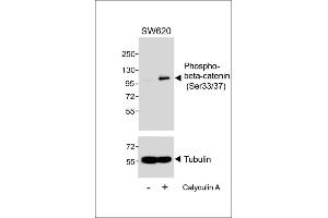 Western blot analysis of extracts from S cells, untreated or treated with Calyculin A, (100nM, 30 min), using Phospho-beta-catenin (Ser33/37) Antibody. (beta Catenin antibody  (pSer33, pSer37))