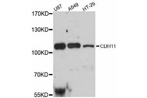 Western blot analysis of extracts of various cell lines, using CDH11 antibody. (OB Cadherin antibody)