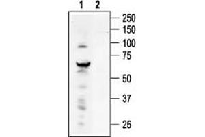 Western blot analysis of ND7/23 Mouse neuroblastoma /rat dorsal root ganglion neuron hybrid cell line lysate: - 1. (TRPV4 antibody  (C-Term, Intracellular))