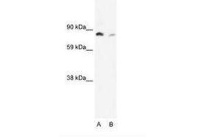 Image no. 2 for anti-Nuclear Factor of kappa Light Polypeptide Gene Enhancer in B-Cells 2 (NFKB2) (AA 65-114) antibody (ABIN6735898) (NFKB2 antibody  (AA 65-114))