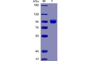 Human CD155 Protein, mFc-His Tag on SDS-PAGE under reducing condition. (Poliovirus Receptor Protein (PVR) (AA 21-343) (mFc-His Tag))