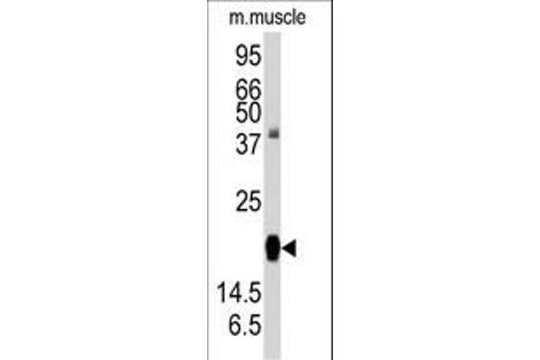 RGS19 antibody  (AA 131-156)