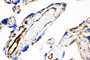 Anti- Caveolin-1 picoband antibody, IHC(P) IHC(P): Human Placenta Tissue (Caveolin-1 antibody  (AA 4-178))