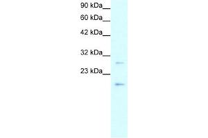 Claudin 1 antibody used at 1-5 ug/ml to detect target protein. (Claudin 1 antibody  (C-Term))