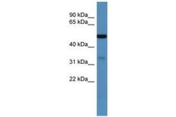 ZDHHC3 antibody  (C-Term)