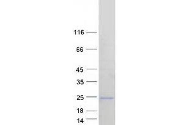 ARL5A Protein (Transcript Variant 3) (Myc-DYKDDDDK Tag)