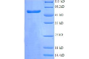 SDS-PAGE (SDS) image for Tripartite Motif Containing 28 (TRIM28) (AA 22-291), (partial) protein (GST tag) (ABIN5712399) (KAP1 Protein (AA 22-291, partial) (GST tag))