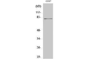 Western Blotting (WB) image for anti-Signal Transducer and Activator of Transcription 4 (STAT4) (pTyr693) antibody (ABIN5957466) (STAT4 antibody  (pTyr693))