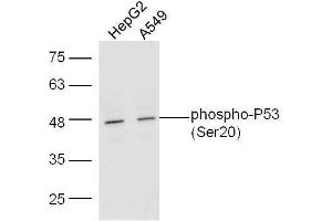 Lane 1: Human HepG2 lysates; Lane 2: Human A549 lysates probed with Rabbit Anti-P53(Ser20) Polyclonal Antibody, Unconjugated  at 1:5000 for 90 min at 37˚C. (p53 antibody  (pSer20))